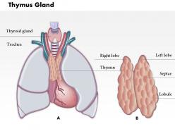 0714 thymus gland medical images for powerpoint