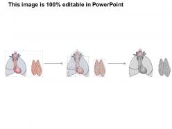 95945754 style medical 2 immune 1 piece powerpoint presentation diagram infographic slide