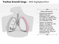 0714 trachea bronchi lungs medical images for powerpoint