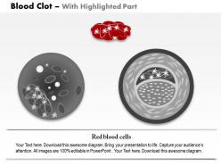 0814 blood clot medical images for powerpoint