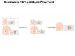 81814108 style medical 2 diseases 1 piece powerpoint presentation diagram infographic slide