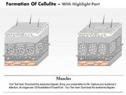 0814 formation of cellulite medical images for powerpoint