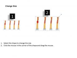 0814 fracture and repair medical images for powerpoint