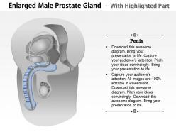 0814 illustration of an enlarged male prostate gland medical images for powerpoint