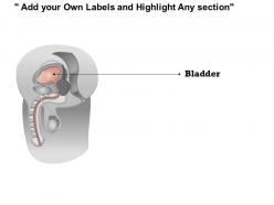 0814 illustration of an enlarged male prostate gland medical images for powerpoint