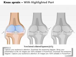 0814 knee sprain medical images for powerpoint