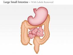 0814 large and small intestine medical images for powerpoint