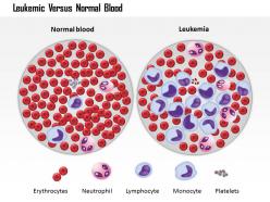 0814 leukemic versus normal blood medical images for powerpoint