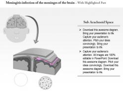 0814 meningitis infection of the meninges of the brain medical images for powerpoint
