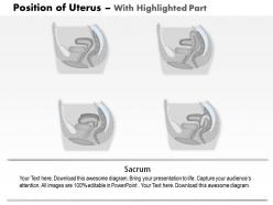 0814 position of uterus medical images for powerpoint