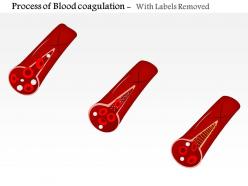 0814 process of blood coagulation medical images for powerpoint