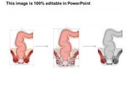 14271911 style medical 1 digestive 1 piece powerpoint presentation diagram infographic slide
