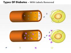 0814 types of diabetes medical images for powerpoint