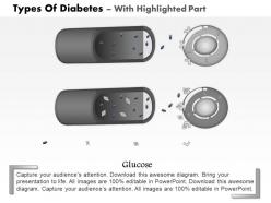 0814 types of diabetes medical images for powerpoint