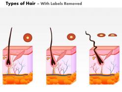 0814 types of hair medical images for powerpoint