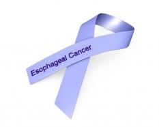 0914 blue ribbon for esophageal cancer awareness stock photo