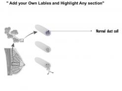 0914 breast cancer medical images for powerpoint