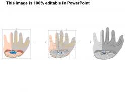 0914 carpal tunnel syndrome diseases medical images for powerpoint