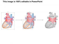 0914 heart posteroinferior medical images for powerpoint