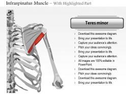 0914 infraspinatus muscle medical images for powerpoint