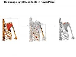 0914 infraspinatus muscle medical images for powerpoint