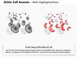 0914 sickle cell anemia medical images for powerpoint