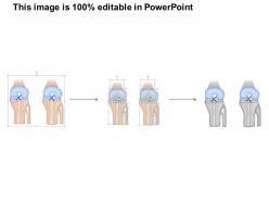 22796608 style medical 1 musculoskeletal 1 piece powerpoint presentation diagram infographic slide