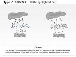 0914 type 2 diabetes medical images for powerpoint