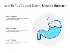 Acid reflux caused due to ulcer in stomach