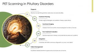 Advances In Pituitary Gland Medical Imaging PPT PowerPoint AT Pre designed Image