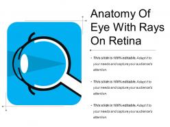 Anatomy of eye with rays on retina
