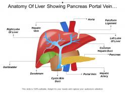Anatomy of liver showing pancreas portal vein falciform ligament