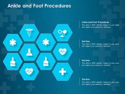 Ankle and foot procedures ppt powerpoint presentation summary show