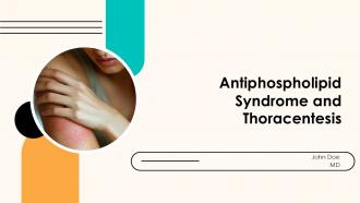 Antiphospholipid Syndrome And Thoracentesis PPT Presentation ACP