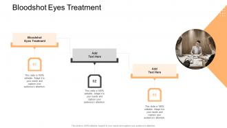 Bloodshot Eyes Treatment In Powerpoint And Google Slides Cpb