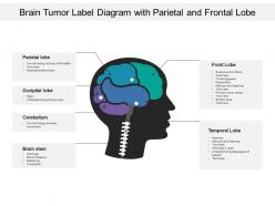 Brain tumor label diagram with parietal and frontal lobe