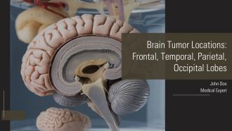 Brain Tumor Locations Frontal Temporal Parietal Occipital Lobes PPT Designs AT