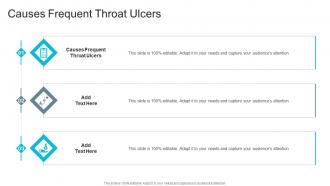 Causes Frequent Throat Ulcers In Powerpoint And Google Slides Cpb