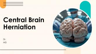 Central Brain Herniation PPT Presentation ACP