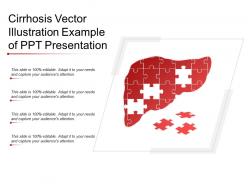 Cirrhosis vector illustration example of ppt presentation