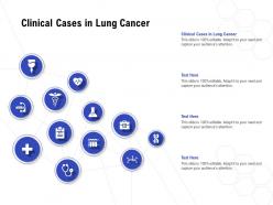 Clinical Cases In Lung Cancer Ppt Powerpoint Presentation Pictures Master Slide