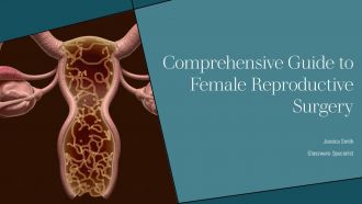 Comprehensive Guide To Female Reproductive Surgery PPT PowerPoint ST AI