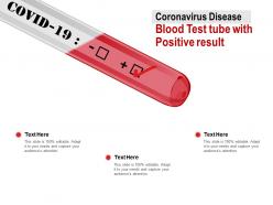 Coronavirus disease blood test tube with positive result