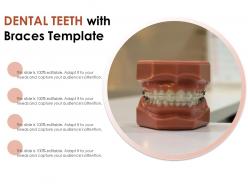 Dental teeth with braces template