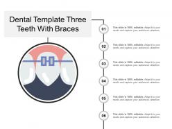 Dental template three teeth with braces