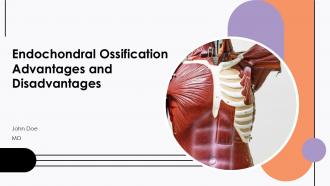Endochondral Ossification Advantages And Disadvantages PPT Information ACP