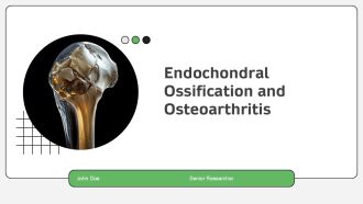 Endochondral Ossification And Osteoarthritis PPT Graphics AT
