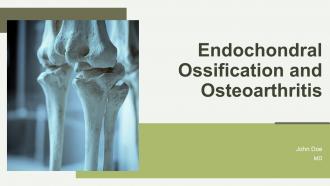 Endochondral Ossification And Osteoarthritis PPT Guidelines ACP