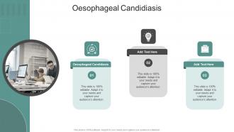 Esophageal Candidiasis In Powerpoint And Google Slides Cpb