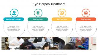 Eye Herpes Treatment In Powerpoint And Google Slides Cpb